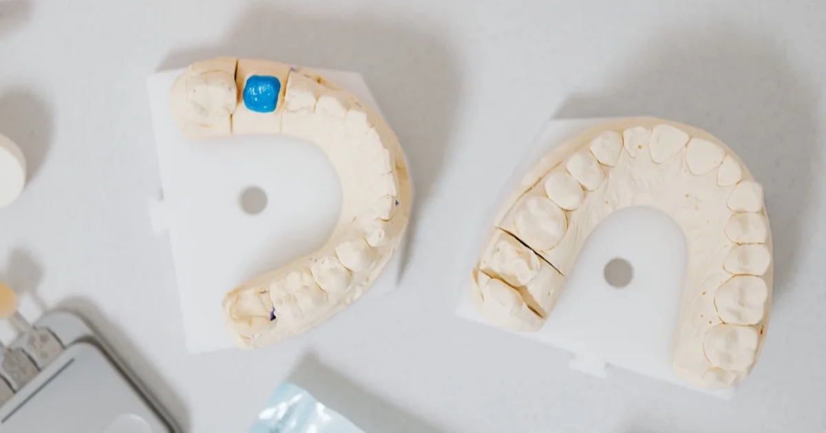 Dental moulds and crown models