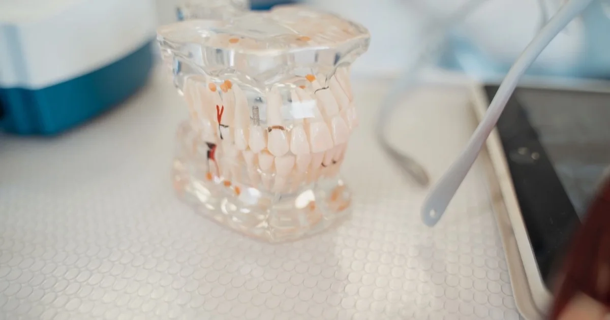 Dental model on a clinic table