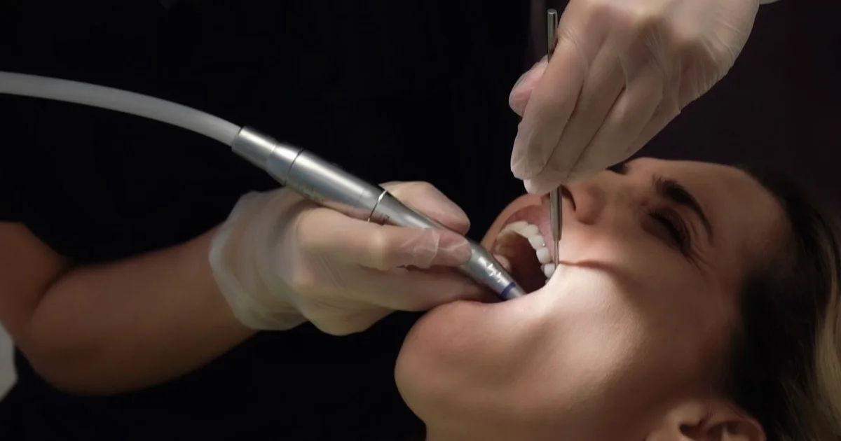 Diş texniki implant protezi üzərində işləyir
