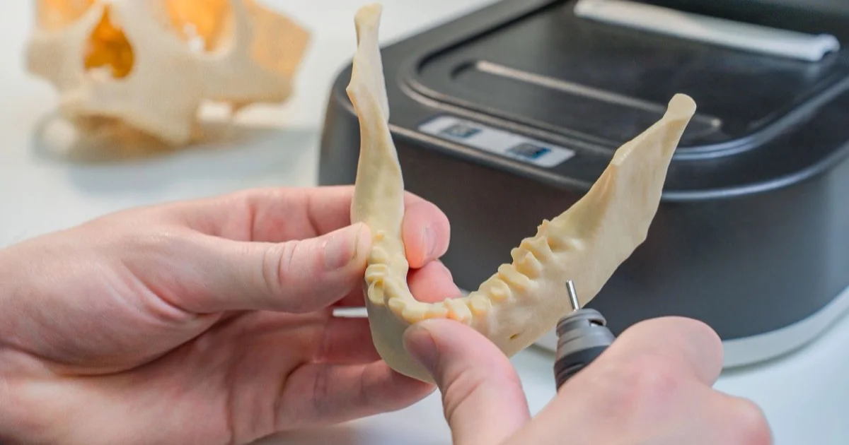 Dental technician designing a prosthesis in CAD software
