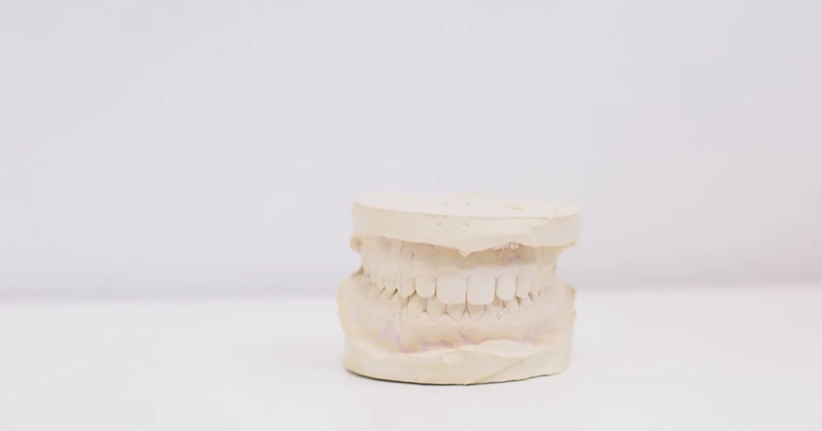 Clear occlusal splint held in the dentist's hand