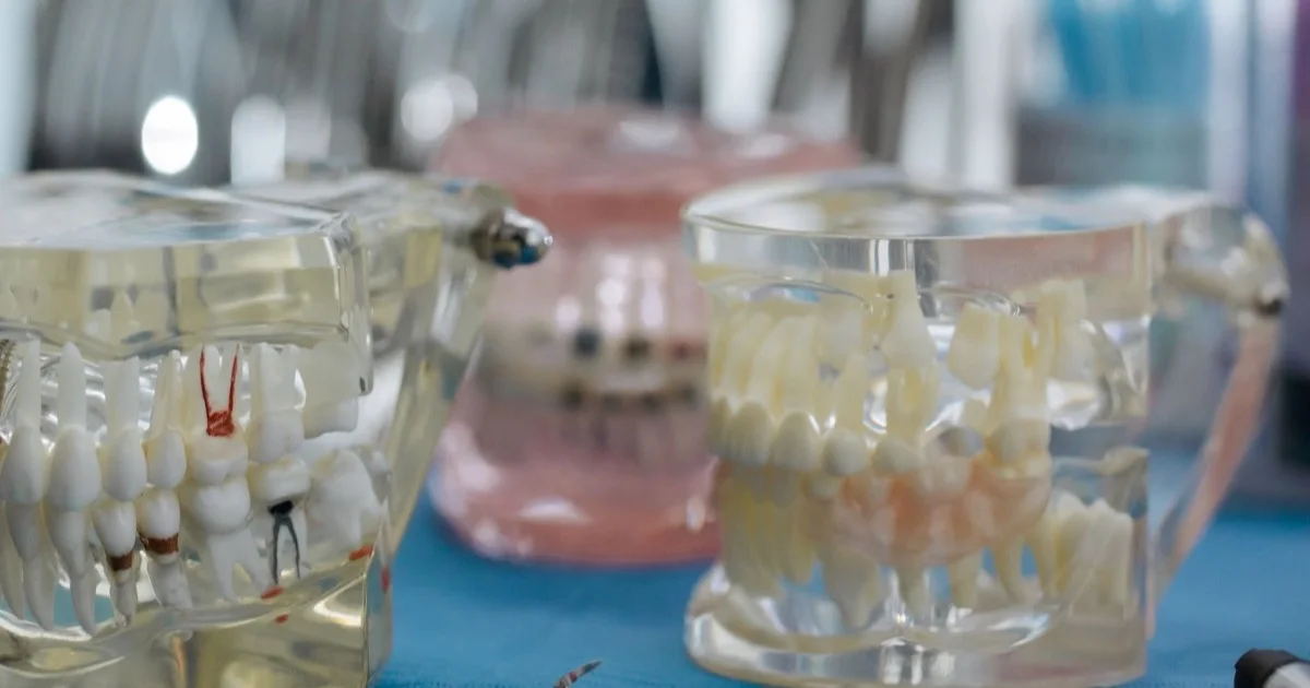 Dental models on a table